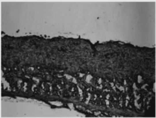Cross-section micrograph — Conventional Sheet Masks (20 min)