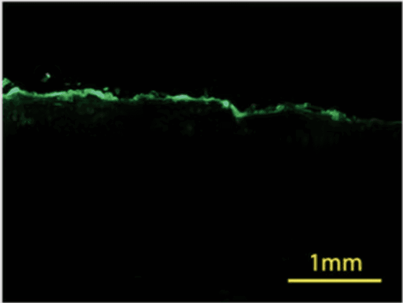 Fluorescent penetration micrograph — Conventional Sheet Masks (20 min)
