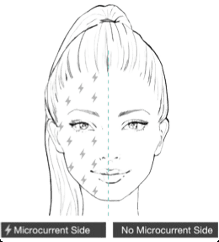 Split-face diagram: microcurrent-printed mask side versus blank mask side