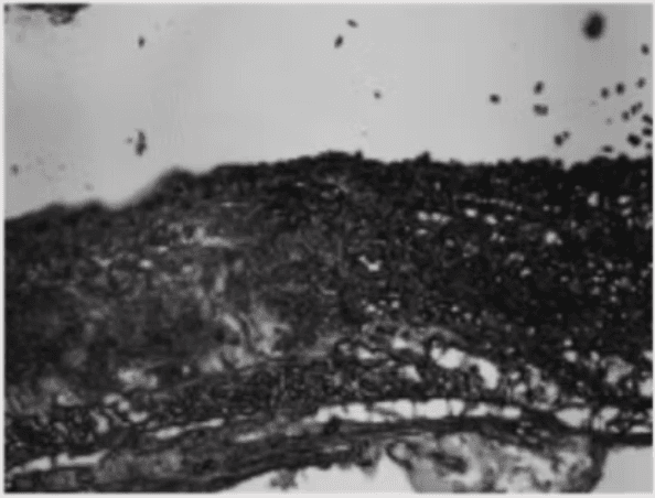 Cross-section micrograph — IonFuse (20 min)