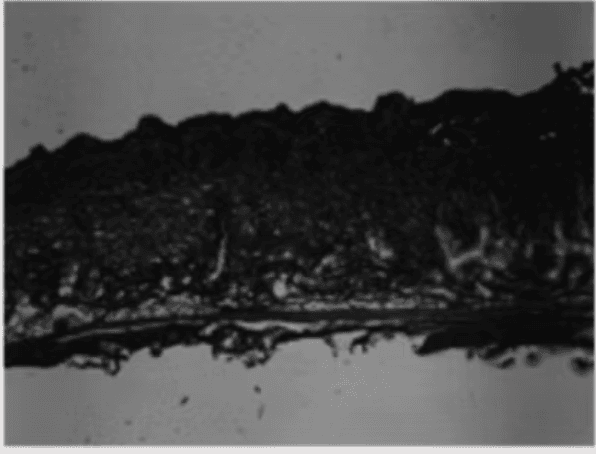 Cross-section micrograph — IonFuse (5 min)