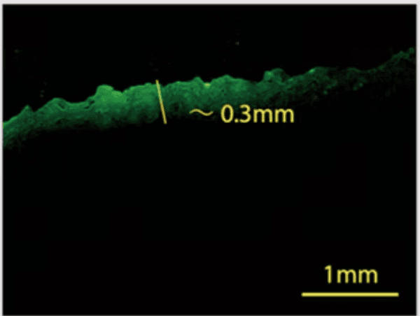 Fluorescent penetration micrograph — IonFuse (5 min)